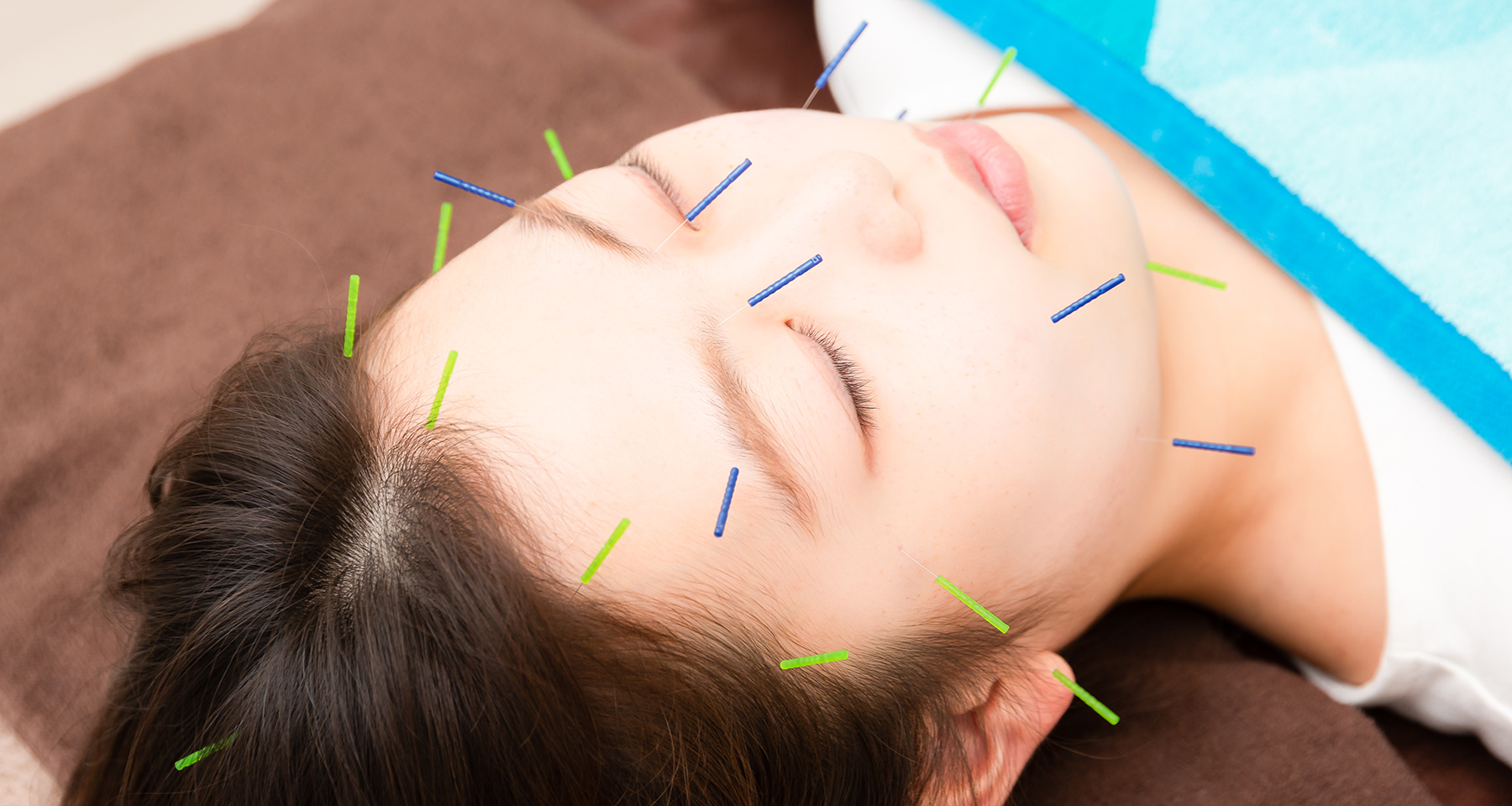Acupuncture<br><small><small><small><b>～鍼灸施術～</b></small></small></small>